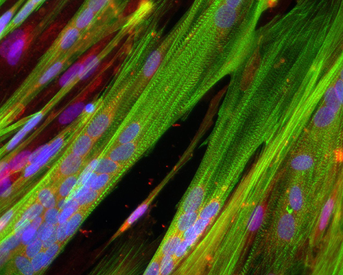 microscope image of green striated human skeletal muscle myotubes by Megan Kondash