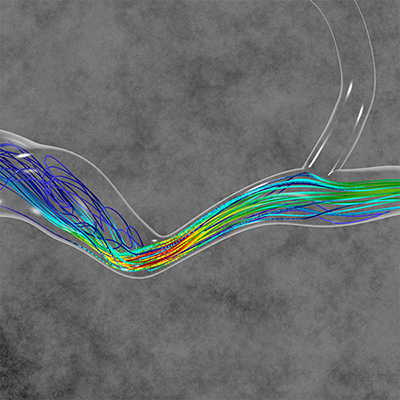 colorful image of blood flow patterns in an arterial channel by Madhurima Vardhan